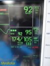 GE 2011  Dash 3000 Series , (SpO2 Nellcor) W/ NEW Leads ~  Patient Monitor