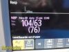 PHILIPS MP30 , MMS Module New Leads Masimo Spo2 IBP/T NBP ECG Print~ Monitor