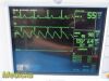 GE Dash 3000 Series , (SpO2 Masimo CO/T EKG NBP), NEW Leads~ Patient Monitor
