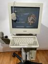 SONY E100-CS1600 Colposcope
