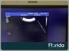 PHILIPS C9-4 CONVEX ARRAY ULTRASOUND TRANSDUCER PROBE REF 453561212362 30 DAYS WARRANTY Ultrasound Transducer