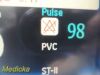 PHILIPS MP70 (M8007A) Neonatal Pt. W/ Printer & MMS Modules Leads~ Monitor