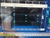 PHILIPS MP70 , W/ NEW Leads & Printer & M3001A Modules~ Critical Care Monitor