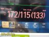 PHILIPS MP70 , W/ NEW Leads & Printer & M3001A Modules~ Critical Care Monitor