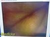 RICHARD WOLF 4840.501 Stereo Panoview 50° Rigid Telescope; TEM Scope