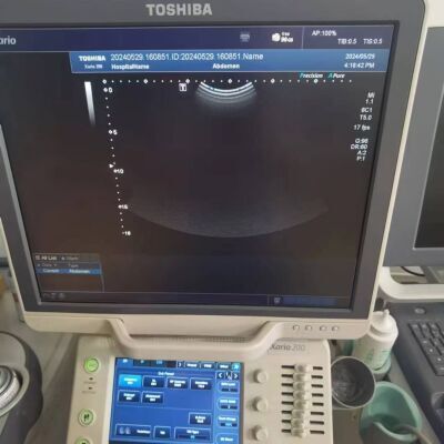 TOSHIBA SN:99B2254607 TOSHIBA Xario 200 Ultrasound Diagnostic System Abdominal Ultrasound Probe PVU-375BT SPO2 Probe