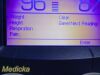 WELCH ALLYN 2015  45NTO 901056 Spot Vital Signs LXI Monitor
