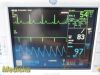 GE 2006  Dash 3000 Series ,(Masimo SpO2) W/ NEW Leads ~ Patient Monitor