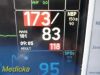 GE 2006  Dash 3000 Series ,(Masimo SpO2) W/ NEW Leads ~ Patient Monitor
