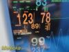 NIHON KOHDEN 2006  Model BSM-5106A Bedside Patient Monitor