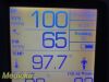 WELCH ALLYN 45NTO Hill Rom Spot Vital Signs LXI Monitor