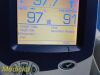 WELCH ALLYN 45NTO Hill Rom Spot Vital Signs LXI Monitor