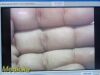 STRYKER ENDOSCOPY Stryker 26" Vision Elect HDTV Surgical Monitor