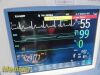 PHILIPS MP30 (M8002A) Neonatal Patient Monitor