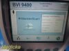 VERATHON BVI9400 Bladder Scanner W/ Battery & 0570-0351 Probe