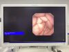 OLYMPUS GIF-N180 Endoscope