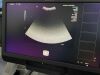 SIEMENS Acuson 4C1 Ultrasound Transducer