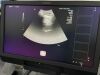 SIEMENS Acuson 4C1 Ultrasound Transducer