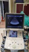 DIAGNOSTIC ULTRASOUND TOSHIBA APLIO XG