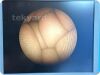 HOLOGIC MyoSure 40-200 Hysteroscope