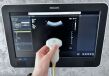 PHILIPS Epiq 5G YOM 2017 General Ultrasound