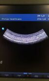 PHILIPS C5-2 Ultrasound Transducer