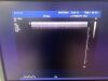 PHILIPS iU22 Ultrasound - Shared Service