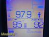 WELCH ALLYN 45NTO Spot Vital Signs LXI Monitor
