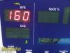 WELCH ALLYN 53NTO Spot, W/ PSU & Leads (TEMP,SPO2,NBP) ~ Vital Signs Monitor