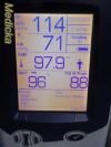 WELCH ALLYN 2014  45NTO Spot Vital Signs LXI Monitor