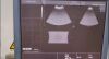 GE RM6C Ultrasound Transducer