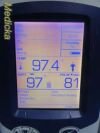 WELCH ALLYN 45NTO Spot Vital Signs LXI,W/ Leads (TEMP, NBP, SPO2) ~ Monitor