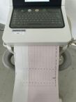 PHILIPS PageWriter TC20 ECG unit