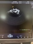 GE HEALTHCARE 8C-RS Ultrasound Transducer