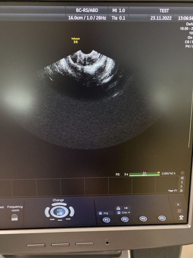 GE HEALTHCARE 8C-RS Ultrasound Transducer