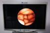 3M Arthroscope 30° 2.7mm 175mm Arthroscope