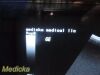 GE HEALTHCARE GE CAE 5mHz Convex Array Ultrasound Probe Model P9603AE *TESTED*