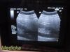 GE HEALTHCARE GE CAE 5mHz Convex Array Ultrasound Probe Model P9603AE *TESTED*