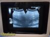 GE HEALTHCARE GE CAE 5mHz Convex Array Ultrasound Probe Model P9603AE *TESTED*