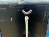 GE Logiq E9  YOM: 2014 With 4 Probes. Ultrasound