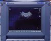 SONOSITE Titan Monitor