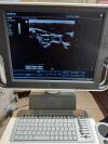 MINDRAY DC-N3 Ultrasound - OB / GYN - Vascular