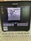 PHILIPS MEDICAL L12-5 50 MM Ultrasound Transducer