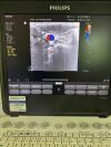 PHILIPS MEDICAL L12-5 50 MM Ultrasound Transducer