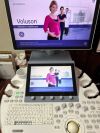 GE VOLUSON E8 Ultrasound Machine