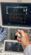 PHILIPS IU22 IE33 Ultrasound Machine