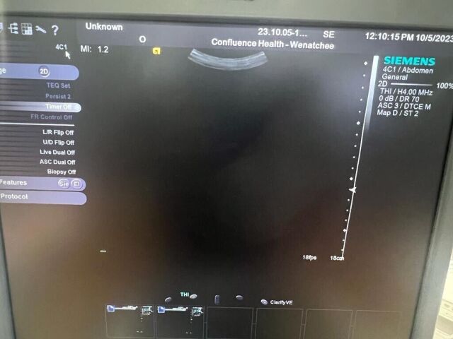 SIEMENS 4C1 Ultrasound Transducer