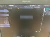 SIEMENS 9L4 Ultrasound Transducer