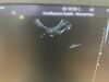 SIEMENS 9EVF4 Ultrasound Transducer