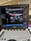 GE 9L-RS Ultrasound Transducer